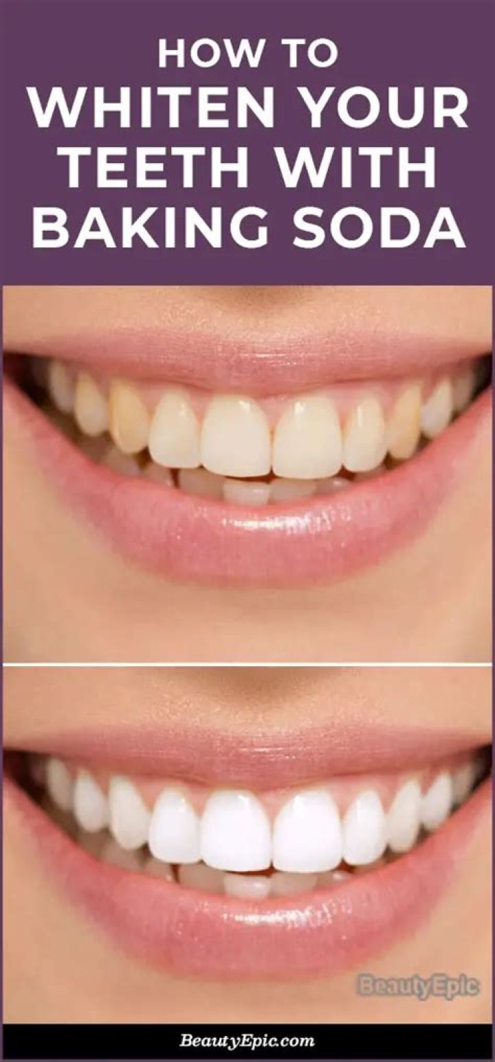 does baking soda whiten teeth