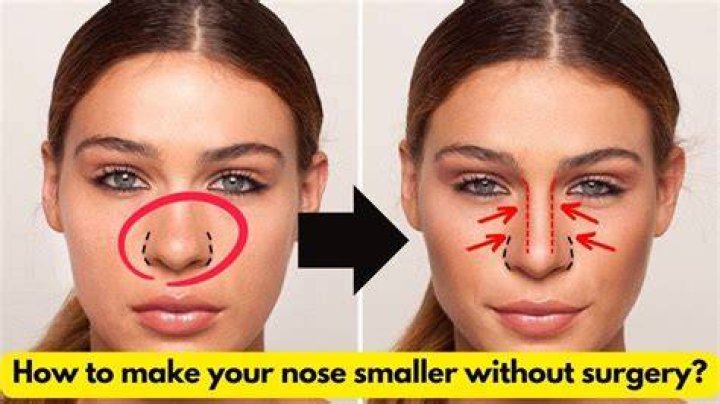 how to make your nose stop running