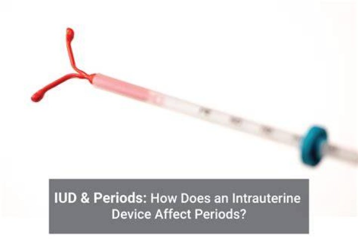 iud stop periods