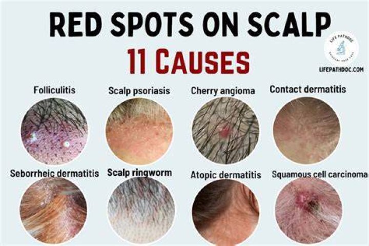 spots on head